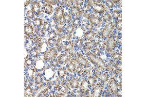 Immunohistochemistry of paraffin-embedded rat kidney using COPS2 antibody (ABIN6130123, ABIN6138877, ABIN6138878 and ABIN6222819) at dilution of 1:100 (40x lens). (COPS2 anticorps  (AA 1-310))