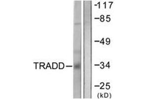 Western blot analysis of extracts from COS7 cells, using TRADD Antibody. (TRADD anticorps  (AA 251-300))