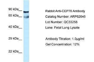 Western Blotting (WB) image for anti-Centrosomal Protein 76kDa (Cep76) (Middle Region) antibody (ABIN2789198) (Cep76 anticorps  (Middle Region))
