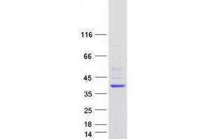 Validation with Western Blot