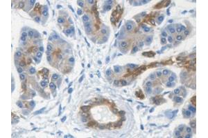 DAB staining on IHC-P; Samples: Human Kidney Tissue (Keratin 33A anticorps  (AA 57-363))
