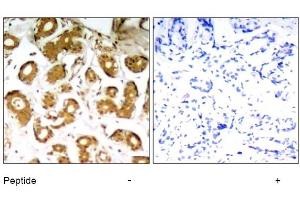 Image no. 1 for anti-Nuclear Factor-kB p65 (NFkBP65) (Thr505) antibody (ABIN319321) (NF-kB p65 anticorps  (Thr505))