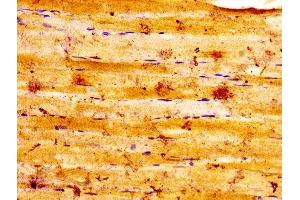 IHC image of ABIN7153211 diluted at 1:100 and staining in paraffin-embedded human skeletal muscle tissue performed on a Leica BondTM system.