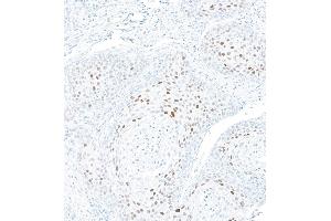 Immunohistochemistry (IHC) image for anti-Cyclin-Dependent Kinase Inhibitor 1A (p21, Cip1) (CDKN1A) (AA 100-150) antibody (ABIN7795764)
