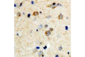 Immunohistochemical analysis of mPR gamma staining in human brain formalin fixed paraffin embedded tissue section. (PAQR5 anticorps  (C-Term))
