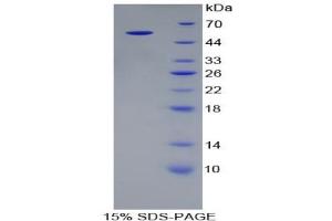 SDS-PAGE of Protein Standard from the Kit (Highly purified E. (ALT Kit CLIA)