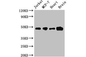 Western Blot Positive WB detected in: Jurkat whole cell lysate, MCF-7 whole cell lysate, Mouse heart tissue, Mouse brain tissue All lanes: ZNF645 antibody at 3. (ZNF645 anticorps  (AA 200-413))