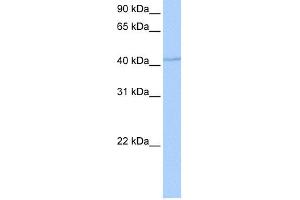 WB Suggested Anti-DPH1 Antibody Titration: 0. (DPH1 anticorps  (Middle Region))