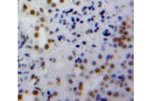 Used in DAB staining on fromalin fixed paraffin-embedded Kidney tissue