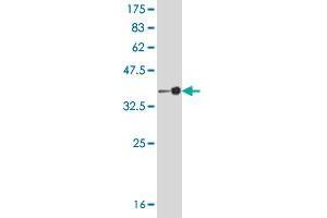 Western Blot detection against Immunogen (37 KDa) . (PCYT2 anticorps  (AA 25-123))