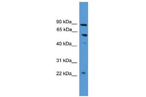 WB Suggested Anti-PDZK1  Antibody Titration: 0.