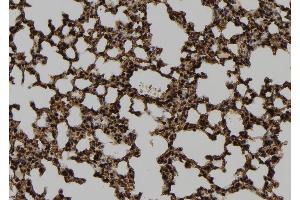 ABIN6278725 at 1/100 staining Mouse lung tissue by IHC-P.