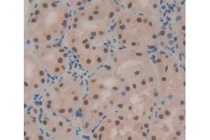 IHC-P analysis of Human Tissue, with DAB staining. (X-Ray Repair Cross Complementing 5 (AA 2-460) anticorps)