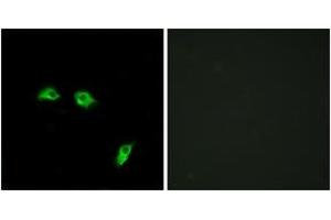 Immunofluorescence analysis of HeLa cells, using GABBR1 Antibody. (GABBR1 anticorps  (AA 891-940))