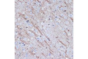 Immunohistochemistry of paraffin-embedded mouse brain using TMOD2 Rabbit mAb (ABIN7271011) at dilution of 1:100 (40x lens).