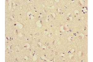 Immunohistochemistry of paraffin-embedded human brain tissue using ABIN7151282 at dilution of 1:100 (TRIM69 anticorps  (AA 1-341))