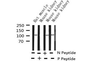 Western blot analysis of Phospho-PKD1/2/3/PKC μ (Ser738+Ser742) expression in various lysates (PKD1/2/3/PKC mu (pSer738), (pSer742) anticorps)