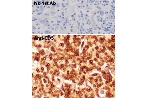 Immunohistochemistry (IHC) image for anti-CD5 (CD5) (AA 105-210) antibody (ABIN7272988) (CD5 anticorps  (AA 105-210))