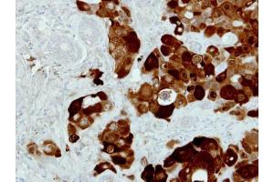 IHC-P Image Immunohistochemical analysis of paraffin-embedded H441 xenograft, using PIG3, antibody at 1:500 dilution.