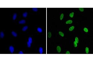 Immunofluorescence analysis of Hela cells using CBX1 mouse mAb (green). (CBX1 anticorps)