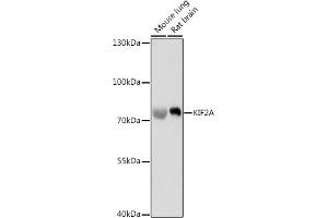 Western blot analysis of extracts of various cell lines, using KIF2A antibody (ABIN7268138) at 1:1000 dilution.