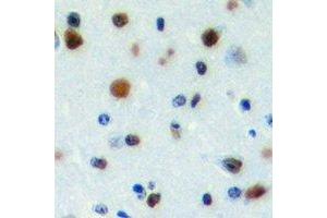 Immunohistochemical analysis of PWWP2B staining in human brain formalin fixed paraffin embedded tissue section. (PWWP2B anticorps)