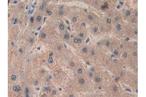 DAB staining on IHC-P;;Samples: Human Liver Tissue (Factor VIII anticorps  (AA 2253-2346))