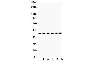 Western blot testing of Rad51 antibody and Lane 1:  22RV1