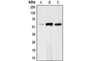 Western blot analysis of CHK1 (pS317) expression in HeLa (A), mouse kidney (B), rat heart (C) whole cell lysates. (CHEK1 anticorps  (pSer317))