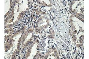 Immunohistochemistry analysis of formalin-fixed paraffin-embedded foetal thyroid gland showing cytoplasmic staining with OSGIN2 Antibody (dilution 1/100).
