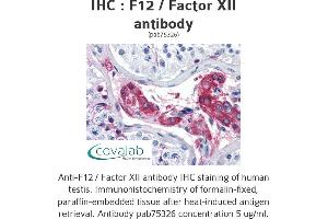 Image no. 2 for anti-Coagulation Factor XII (F12) antibody (ABIN1734212) (F12 anticorps)