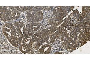 IHC analysis of MPI using anti-MPI antibody (ABIN7600514). (MPI anticorps  (AA 2-99))