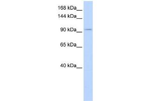 WB Suggested Anti-SALL3 Antibody Titration:  0. (SALL3 anticorps  (Middle Region))