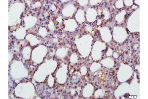 Paraformaldehyde-fixed, paraffin embedded Rat Lung Antigen retrieval by boiling in sodium citrate buffer (pH6.