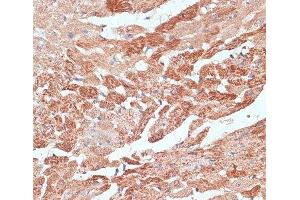 Immunohistochemistry of paraffin-embedded Mouse heart using TMX1 Polyclonal Antibody at dilution of 1:100 (40x lens). (TMX1 anticorps)