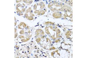 Immunohistochemistry of paraffin-embedded human stomach using IFNL1 antibody at dilution of 1:100 (40x lens). (IL29 anticorps)
