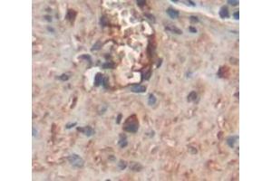 IHC-P analysis of Rat Tissue, with DAB staining. (COMP anticorps  (AA 235-423))