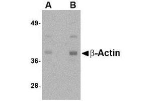 Image no. 1 for anti-Actin, beta (ACTB) (N-Term) antibody (ABIN341736) (beta Actin anticorps  (N-Term))