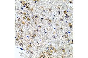 Immunohistochemistry of paraffin-embedded mouse brain using CAST antibody (ABIN3015047, ABIN3015048, ABIN5663576 and ABIN6213614) at dilution of 1:100 (40x lens). (Calpastatin anticorps  (C-Term))