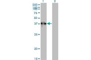 Western Blot analysis of TEX264 expression in transfected 293T cell line by TEX264 monoclonal antibody (M01), clone 2A3-1A10. (TEX264 anticorps  (AA 1-313))
