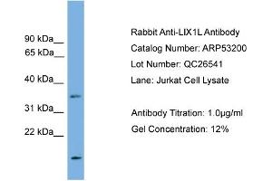 WB Suggested Anti-LIX1L  Antibody Titration: 0. (LIX1L anticorps  (N-Term))