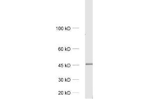 dilution: 1 : 1000, sample: rat brain homogenate (GIPC1 anticorps)