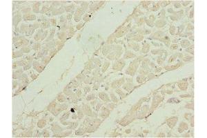 Immunohistochemistry of paraffin-embedded human heart tissue using ABIN7169525 at dilution of 1:100 (SHOX2 anticorps  (AA 72-331))