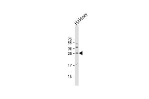 Anti-SOST Antibody (N-term) at 1:500 dilution + human kidney lysate Lysates/proteins at 20 μg per lane. (Sclerostin anticorps  (N-Term))