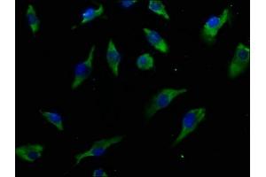 Immunofluorescence staining of U251 cells with ABIN7156793 at 1:50, counter-stained with DAPI.