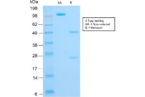 SDS-PAGE Analysis Purified Cytokeratin 16 Mouse Recombinant Monoclonal Antibody (KRT16/1714). (Recombinant KRT16 anticorps  (C-Term))