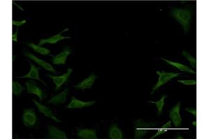 Immunofluorescence of monoclonal antibody to DST on HeLa cell.