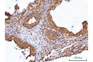 IHC analysis of TIP49A/RUVBL1 using anti-TIP49A/RUVBL1 antibody (ABIN7599928). (RUVBL1 anticorps  (AA 13-23))