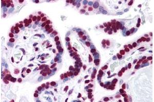 Human Placenta: Formalin-Fixed, Paraffin-Embedded (FFPE)