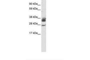 Image no. 1 for anti-Sirtuin 5 (SIRT5) (C-Term) antibody (ABIN202187) (SIRT5 anticorps  (C-Term))